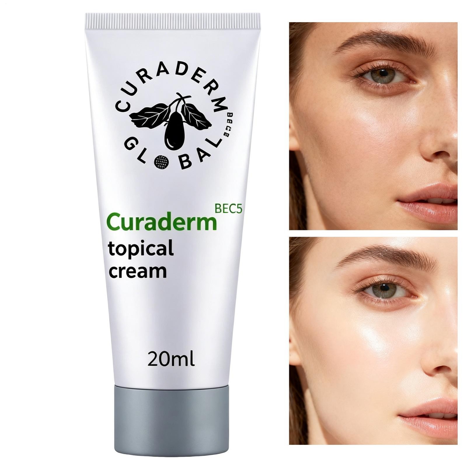 Curaderm BEC5 Cream 20ml New in Stock