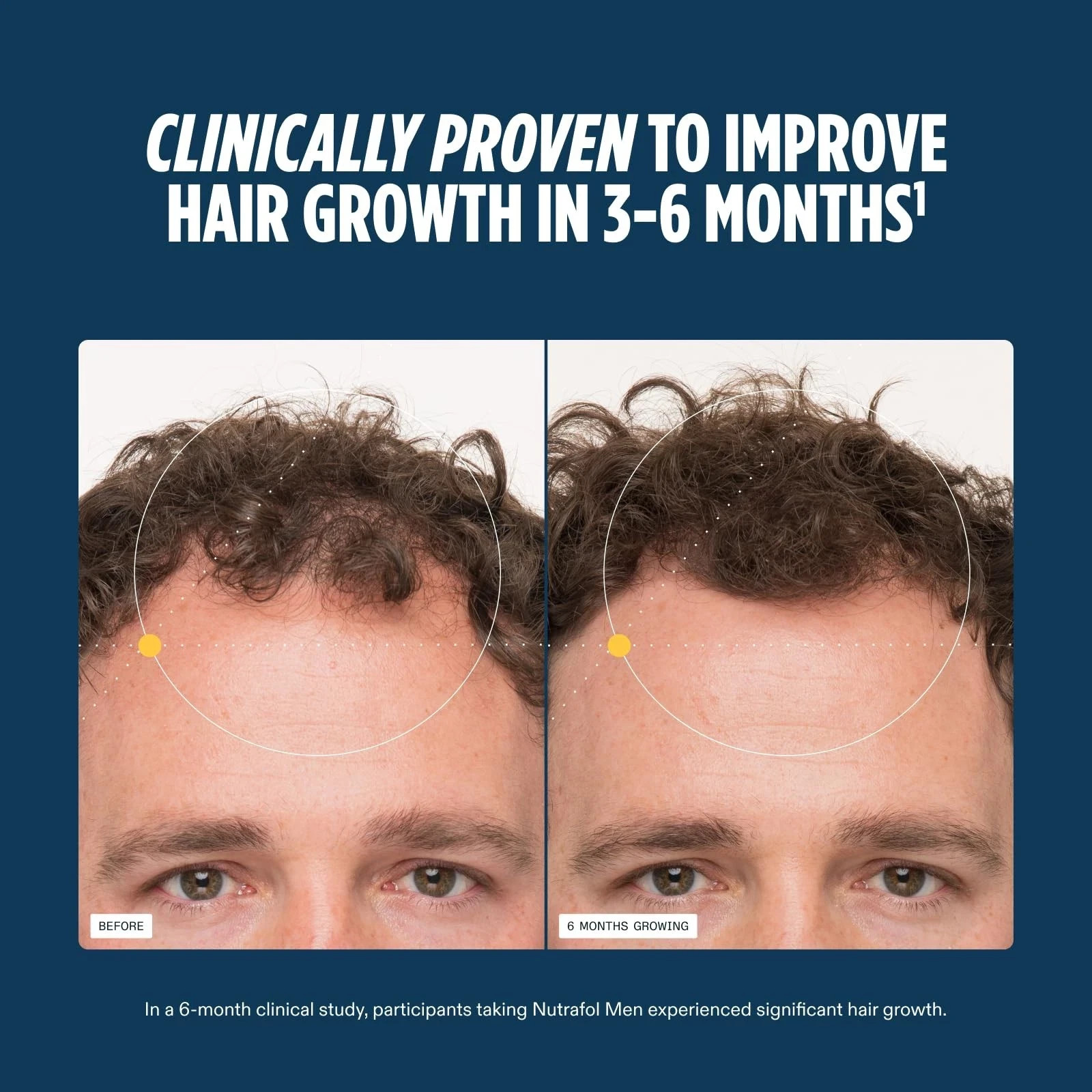 NUTRAFOL Men’s AUTHENTIC Hair Growth 1 Bottle 120 Pills 1 month supply