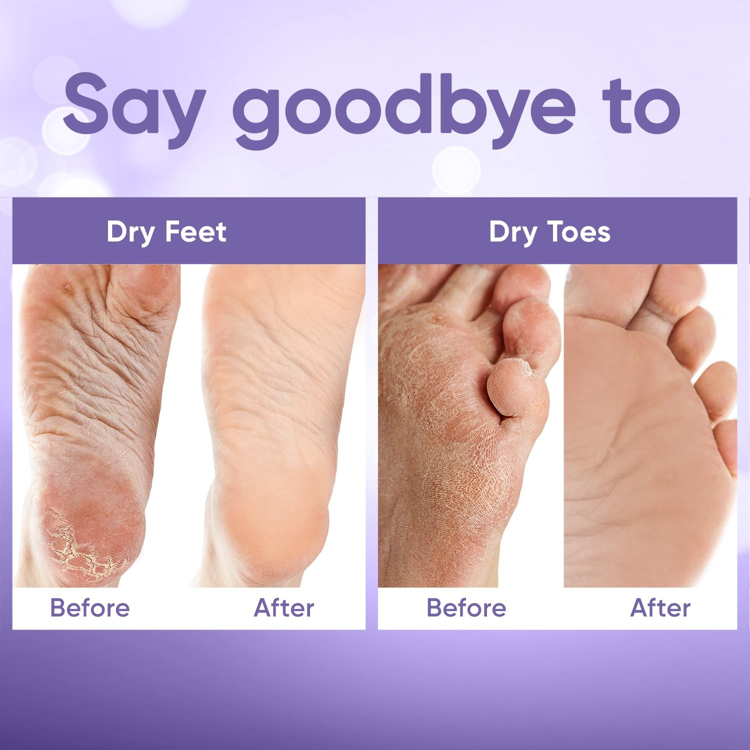 Foot Peel Mask – for Baby Soft Skin – Remove 2 Pair (Pack of 1)