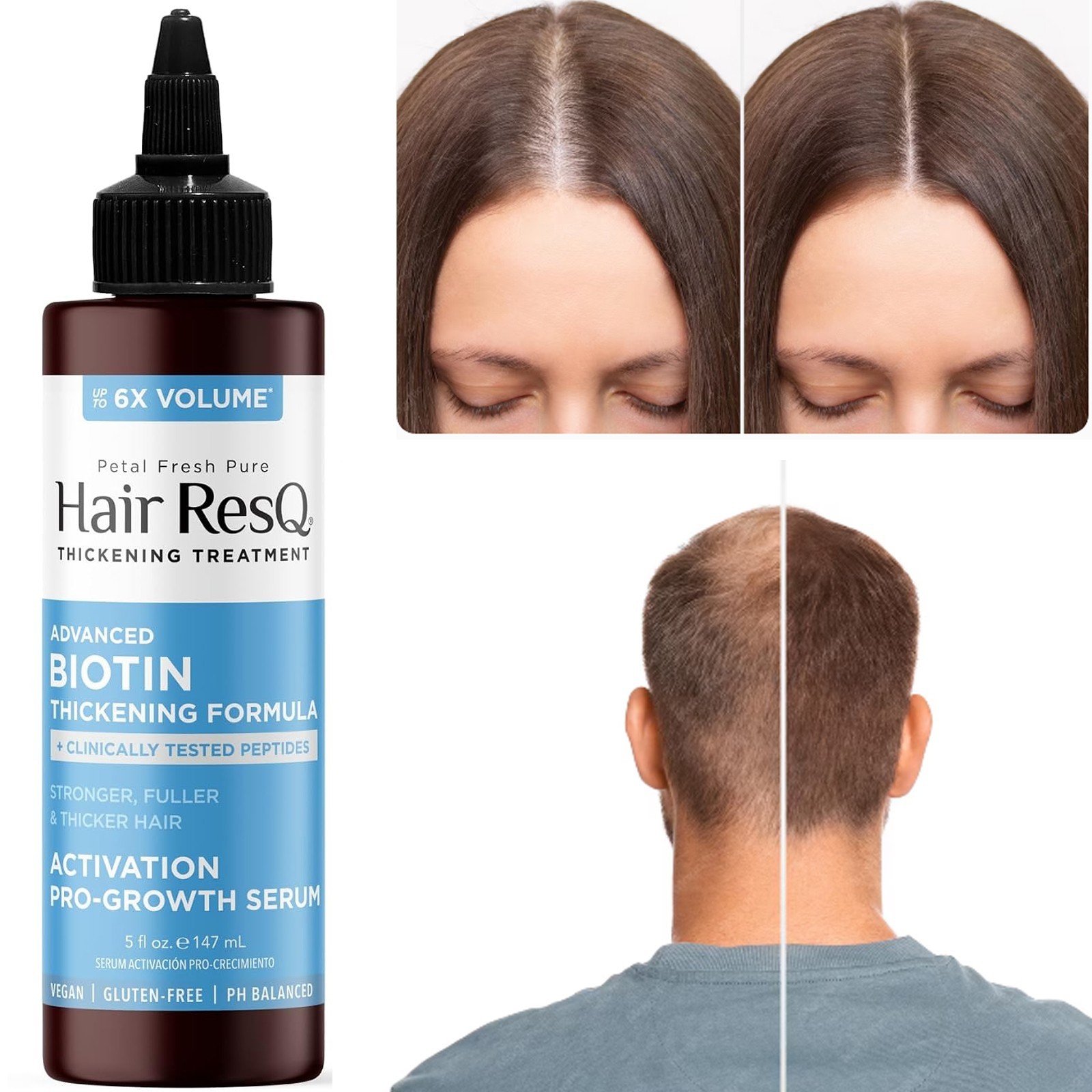 Biotin Thickening Serum Pro Hair Growth Formula with Peptides & Biotin – 5 fl oz