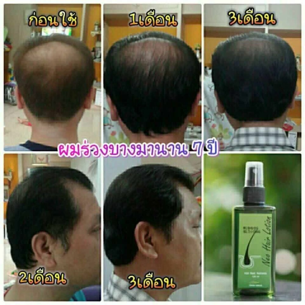 120ml. Neo Hair Lotion Hair Root HAIR BEARD SIDEBURNS LONGER Herbs 100%