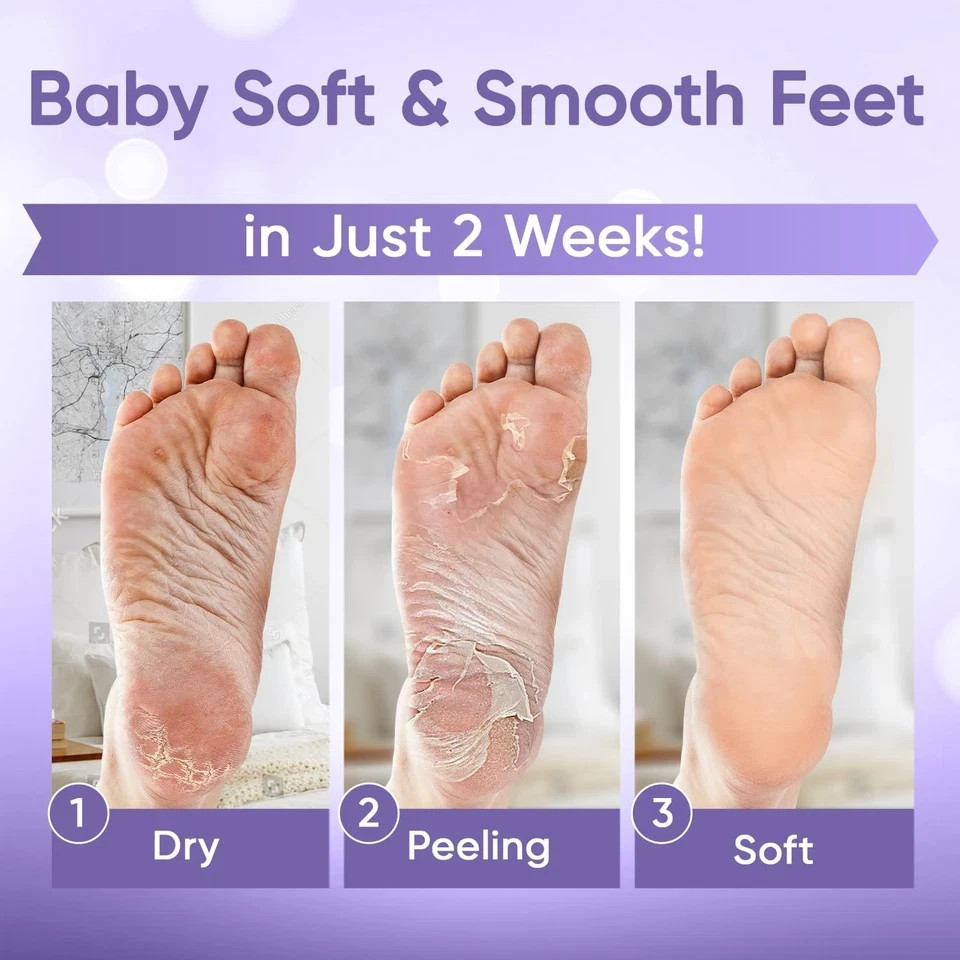Foot Peel Mask – for Baby Soft Skin – Remove 2 Pair (Pack of 1)