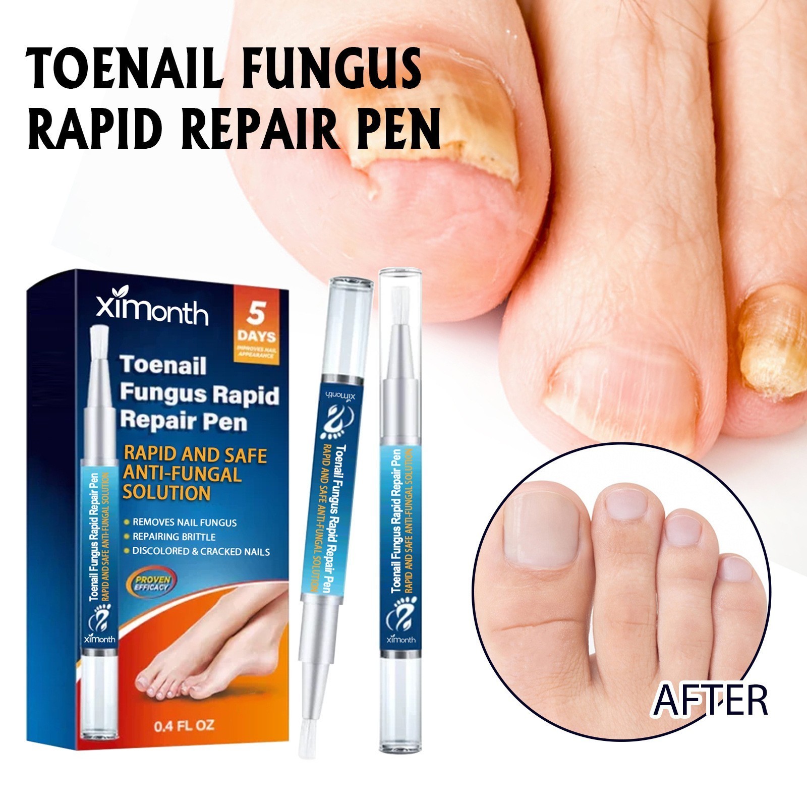 Nail Care Pen, 4/8/12Pcs Fungal Nail Pen, Nail Fungus Treatment For Toenail USA