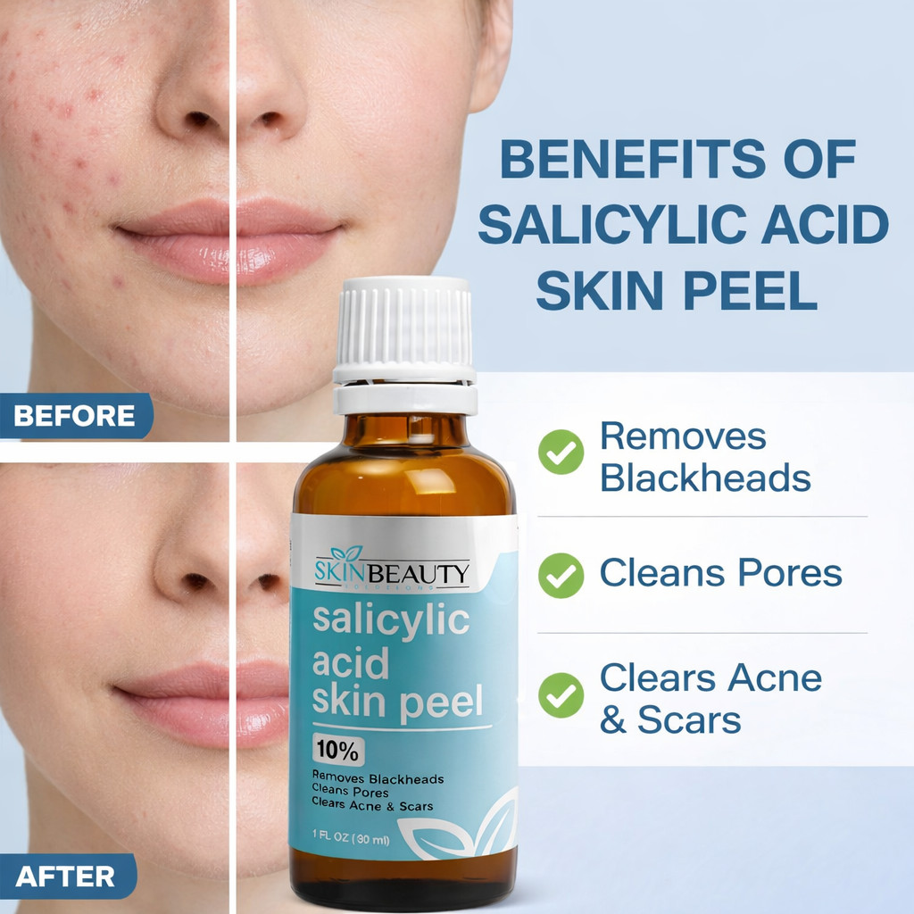 Salicylic Acid Skin Peel 10% 20% 30% Exfoliating Face Care Solution