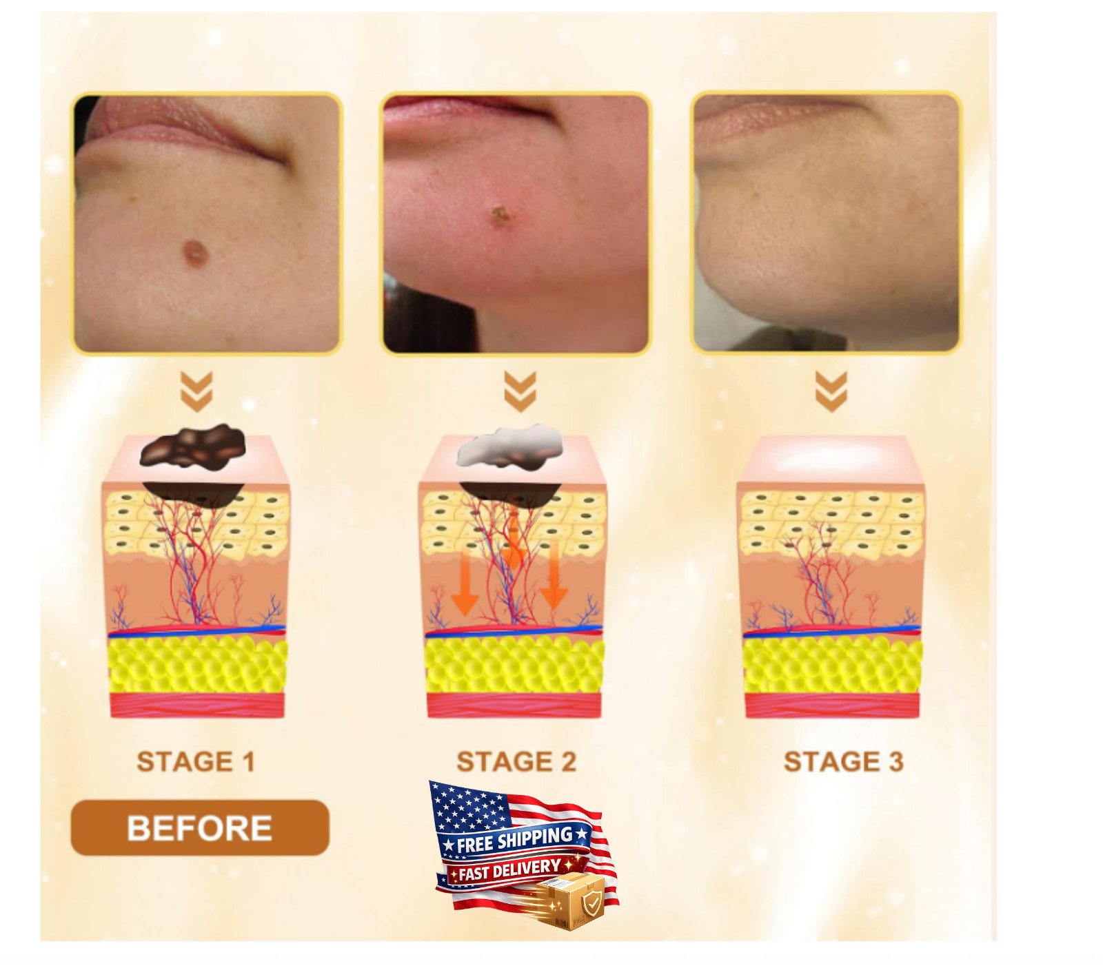 Bee Venom All-In-One Cream Skin Treatment 2026 Professional Bee Venom Cream 60g