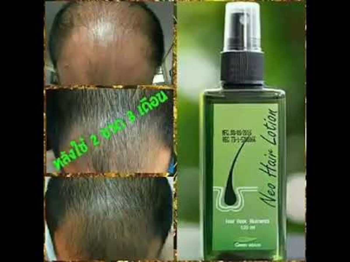 120ml. Neo Hair Lotion Hair Root HAIR BEARD SIDEBURNS LONGER Herbs 100%