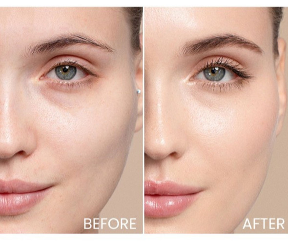 La Roche-Posay Hyalu B5 Serum Anti-Wrinkle Concentrate Repairing Replumping 30ml