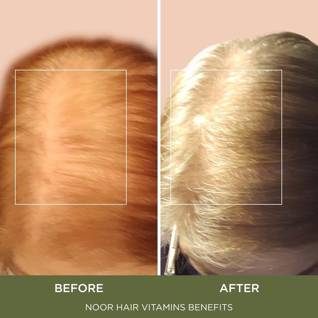 NOOR HAIR Healthy Hair Formula, Hair Growth Supplement Supporting Thick Hair NEW