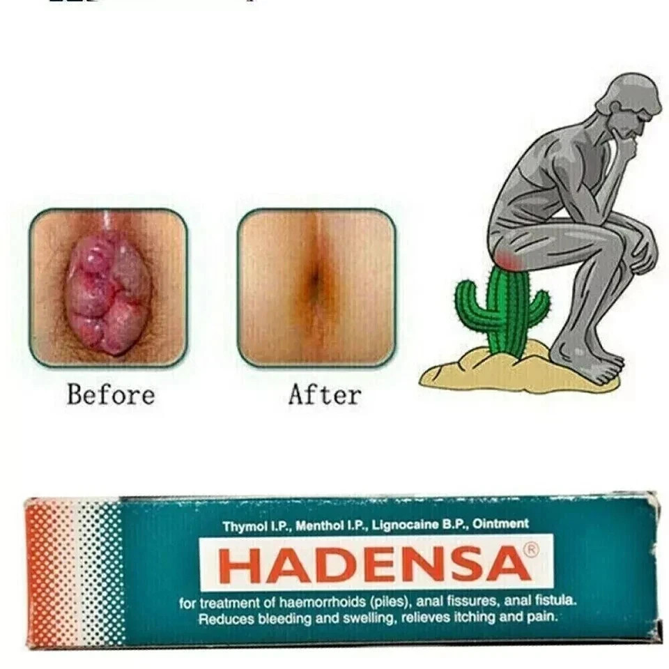 Hadensa Herbal Ointment 40g x 10 | Exp 09/2028 | Natural Relief for Hemorrhoids