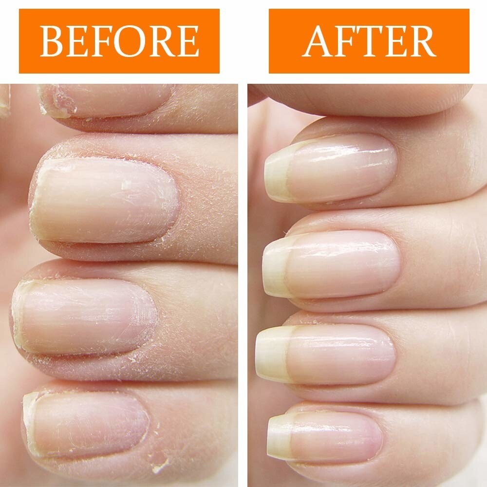 Mix Taste Cuticle Revitalizer Oil Pen Nail Art Care Dry Skin Treatment Manicure