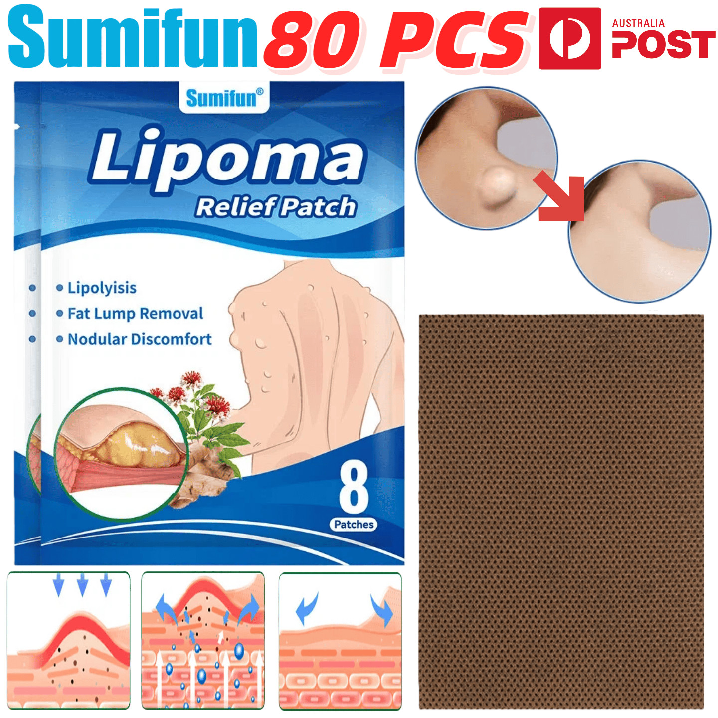 80PCS SUMIFUN Lipoma Removal Patches Herbal Lipolysis Fat Lump Relief Plaster AU