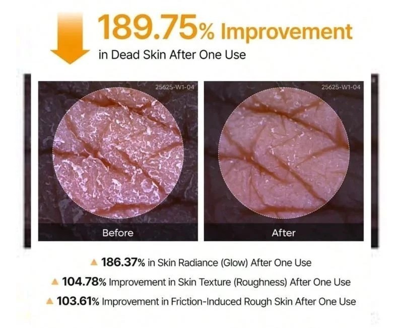 Dr. Melaxin Peel Shot Exfoliant Kojic Acid Turmeric Spray 200ml NEW