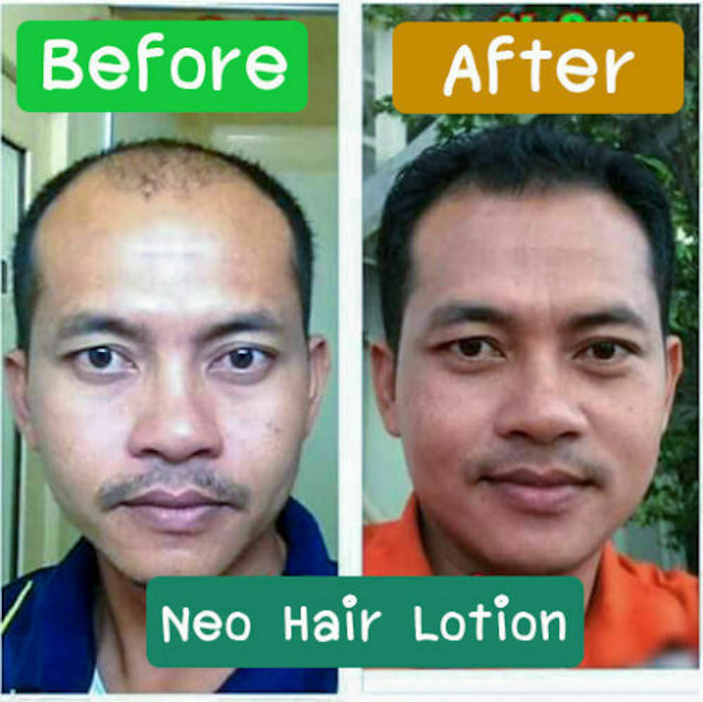 120ml. Neo Hair Lotion Hair Root HAIR BEARD SIDEBURNS LONGER Herbs 100%
