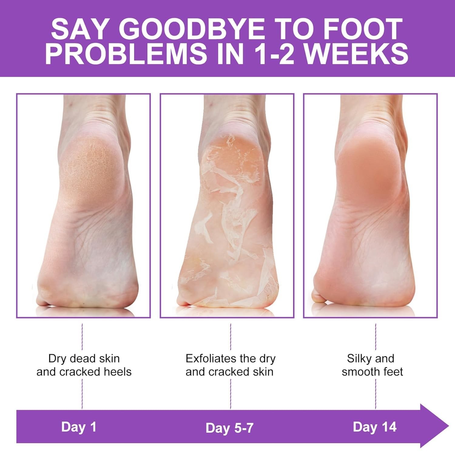Lavender-scented Foot Peel Mask 3 Pack – Exfoliator for Baby Soft Feet