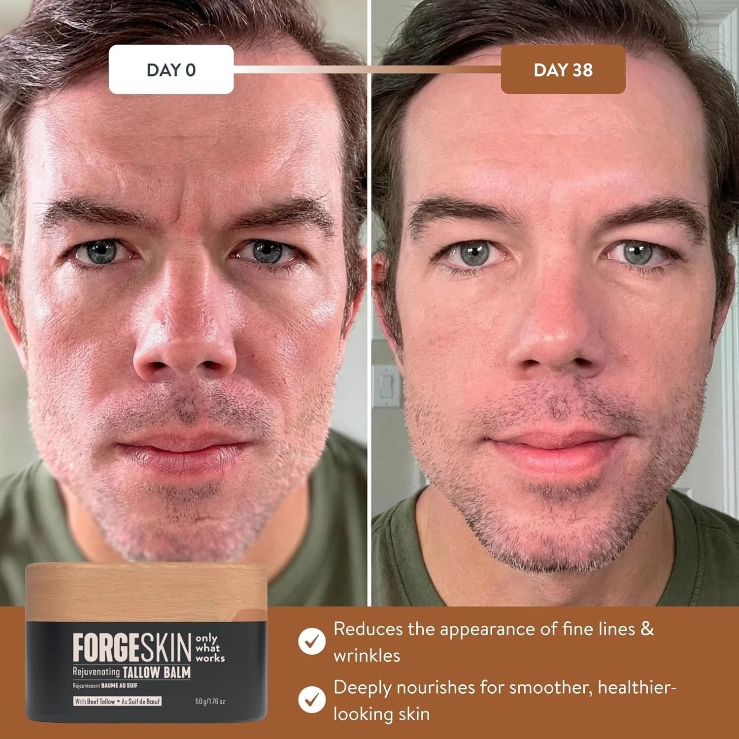 FORGE SKIN® Wrinkle Defense Beef Tallow Balm for Men [TALLOW-BASED] Moisturiz