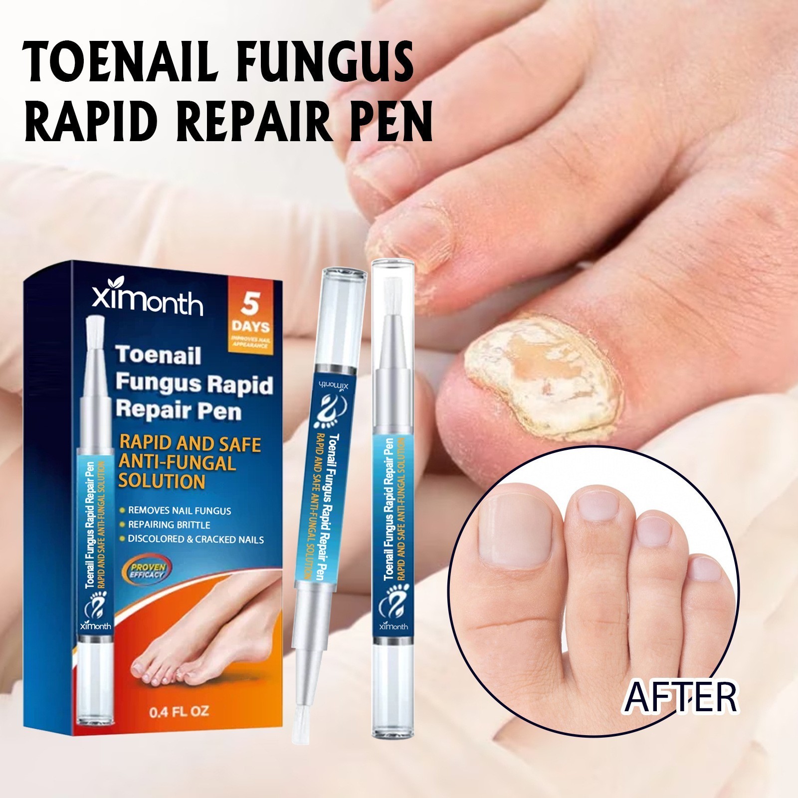 Nail Care Pen, 4/8/12Pcs Fungal Nail Pen, Nail Fungus Treatment For Toenail USA