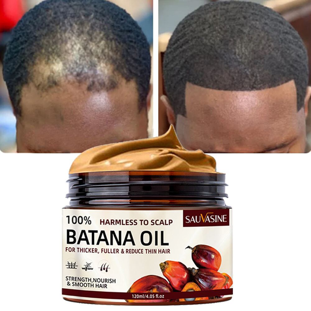 Natural Organic Batana Oil for Hair Growth, Thicker Fuller&Heal Thicker Hair US