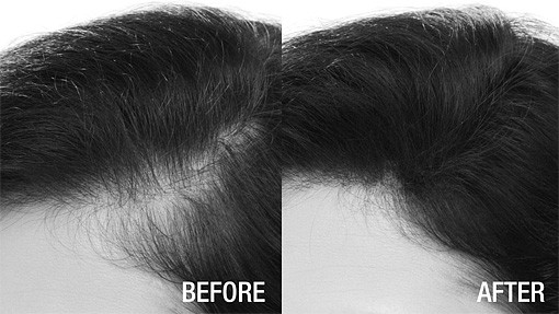 Nanogen Keratin Hair Building Fibers Concealer 15 Grams/0.53 Oz, Package Varies