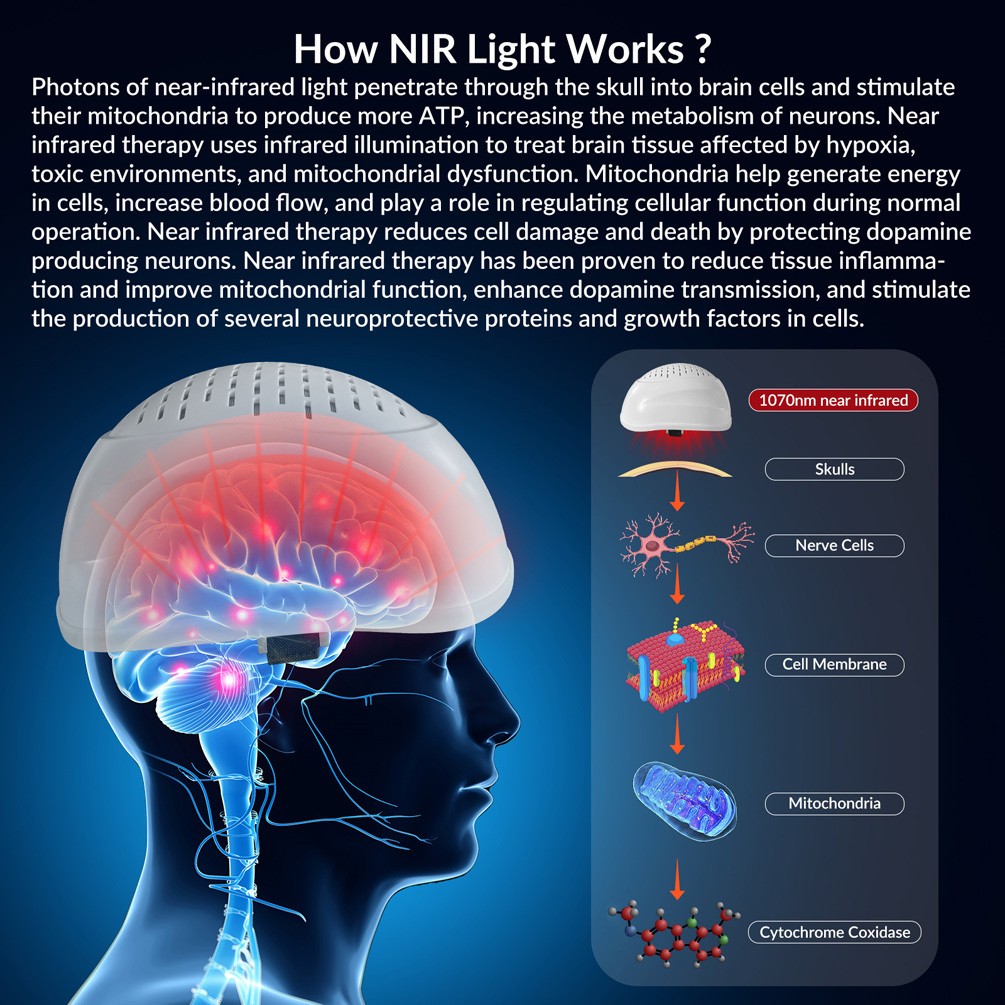Brain Photobiomodulation 1070nm Near Infrared Light Therapy Helmet for Migraine