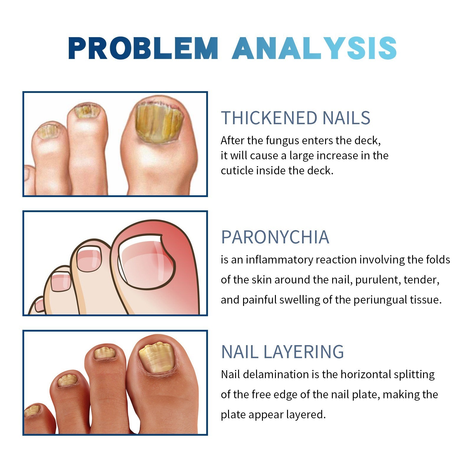 Nail Care Pen, 4/8/12Pcs Fungal Nail Pen, Nail Fungus Treatment For Toenail USA