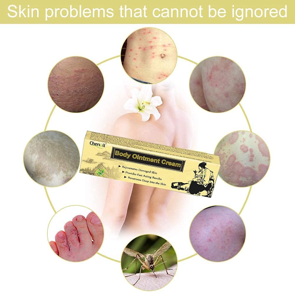 2x Crema De Vitiligo Hidratante Tratamiento Natural Reduce Manchas Blancas 2026