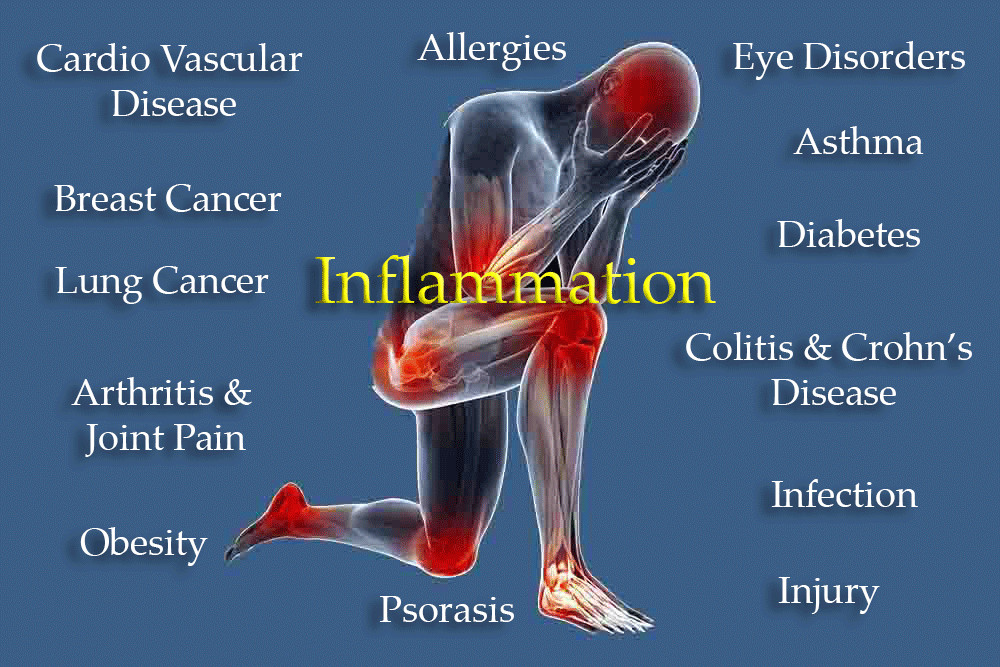 Flamasil® 3 Pack #87- Inflammation, Arthritis, Gout, and Cellular Health