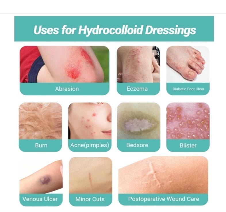 Upgraded 2in*16ft Hydrocolloid Roll for Wound Care, Hydrocolloid Patch Large new