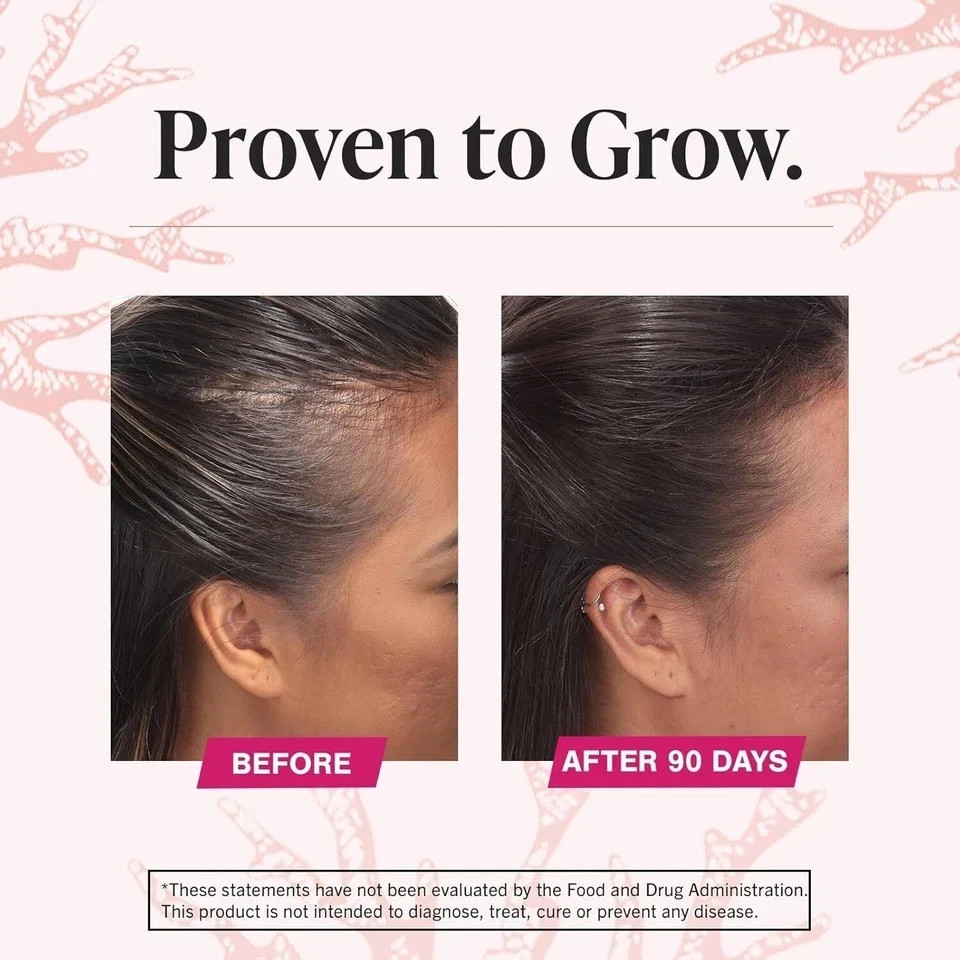 2pcs Viviscal Hair Growth Dietary Supplement Tablets 360 features Collagen Compl