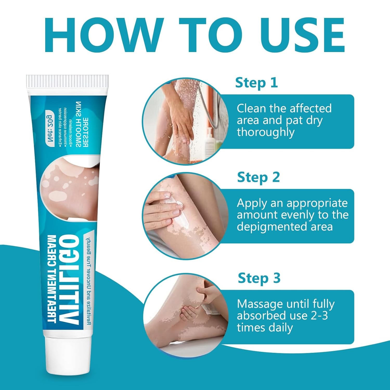 Natural Vitiligo Cream, Improves White Spots & Skin Pigmentation