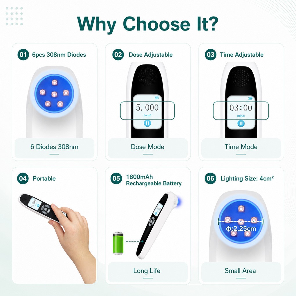 Handheld 308nm UVB Phototherapy Light for Face and Body Skin Wellness Home Use