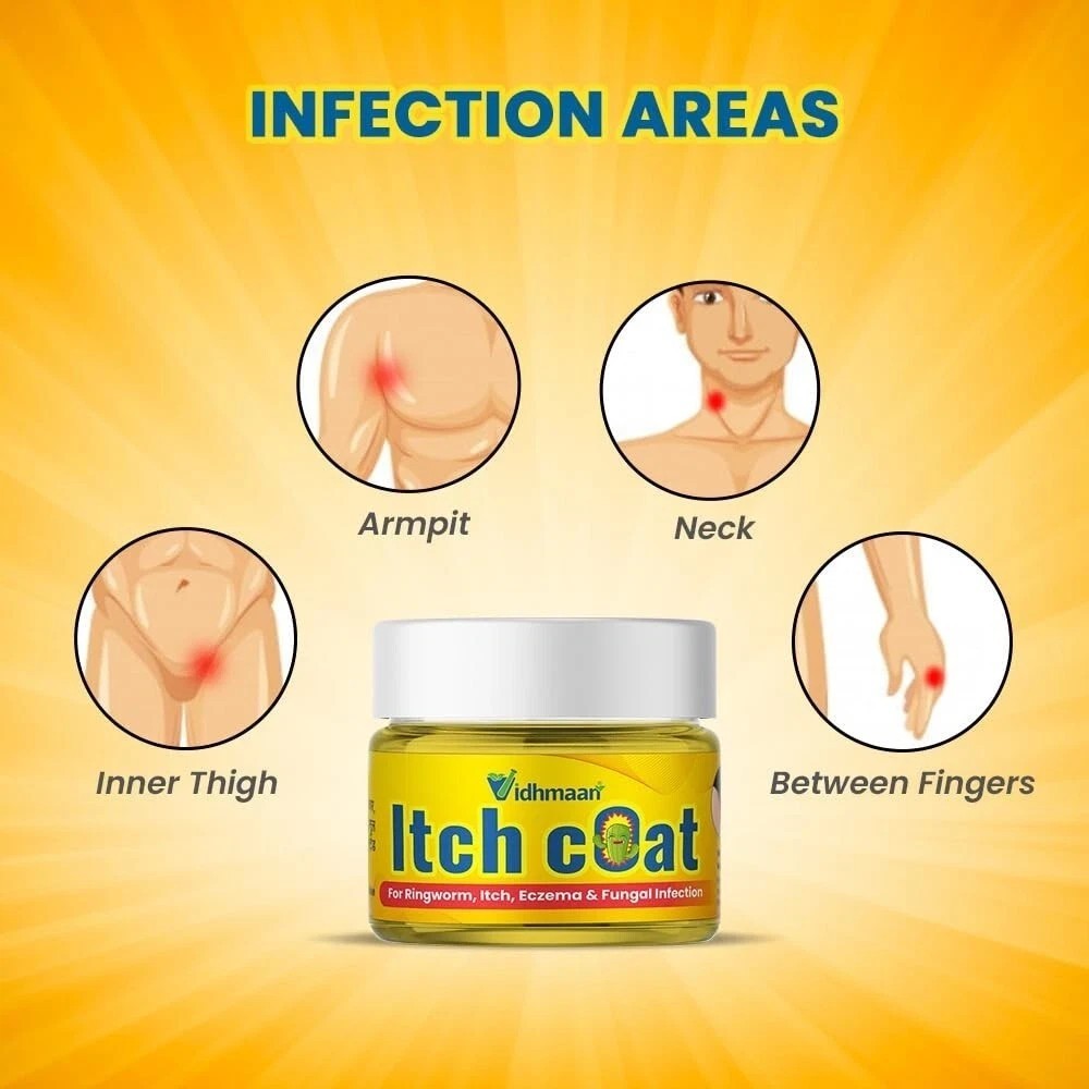 3 X Vidhmaan Ayurveda Itch Coat fungal Malam Ointment – for Ringworm, itching