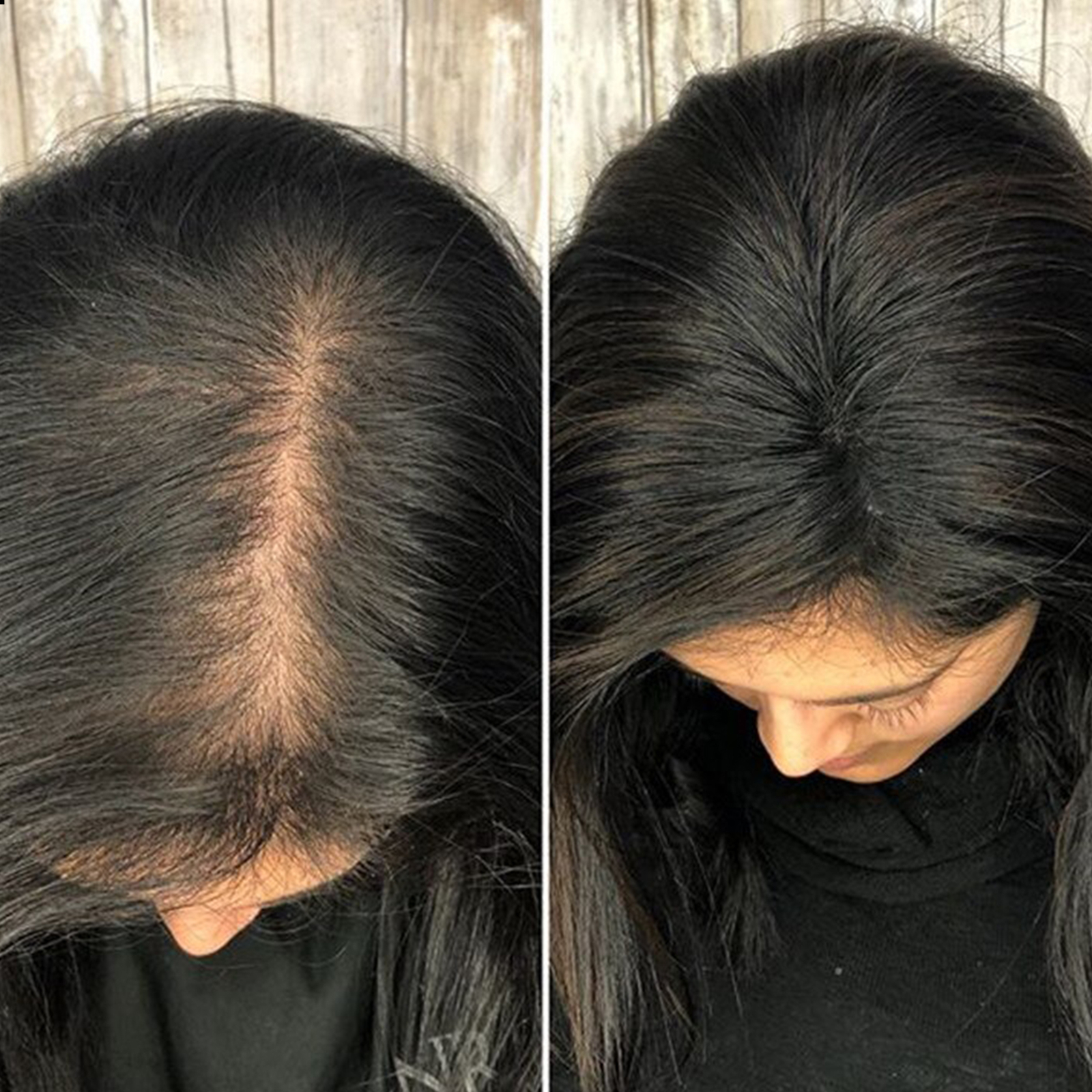 US CLEARANCE 100% Real Human Hair Clip In Top Topper Remy Piece Silk Base Toupee