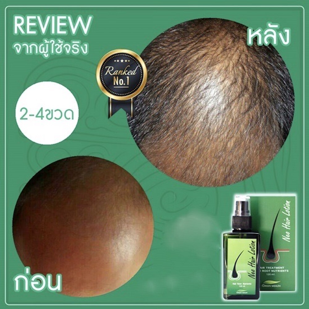 120ml. Neo Hair Lotion Hair Root HAIR BEARD SIDEBURNS LONGER Herbs 100%