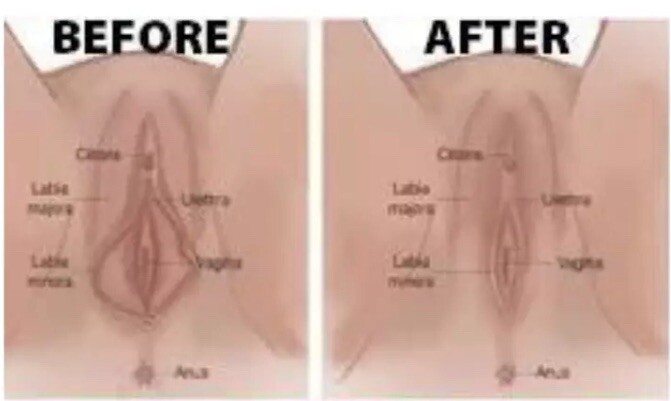 Detox Feminine Rejuvenation Tightening Gel Tight Loose Detox Anti Odor Itching