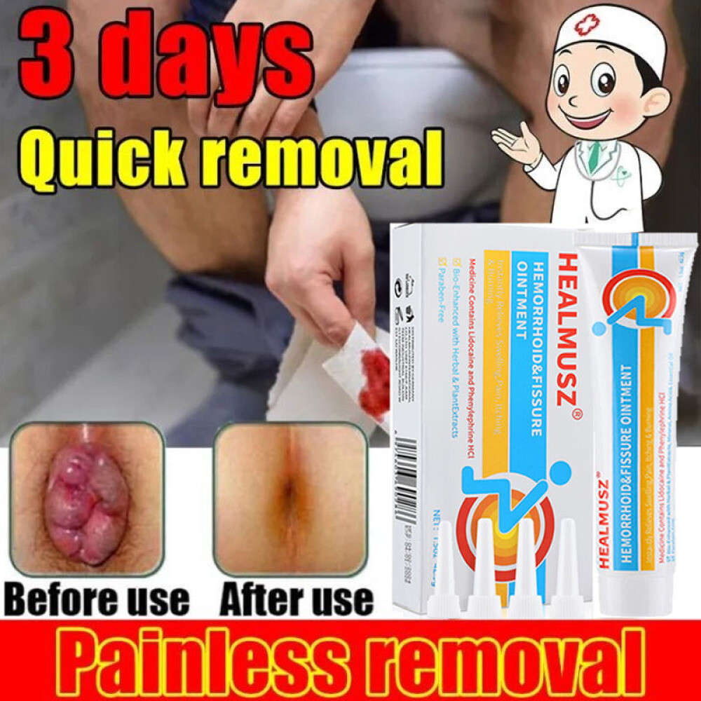 42.5g Hemorrhoids Remove Ointment Herbal Cream Relief Piles Pain Reduce Itching