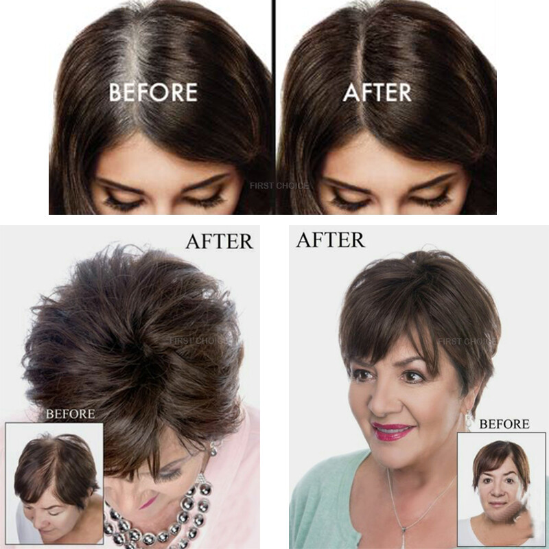 Top Lace Women Topper Clip In Remy Human Hair Toupee Hairpiece Bangs Lightweight