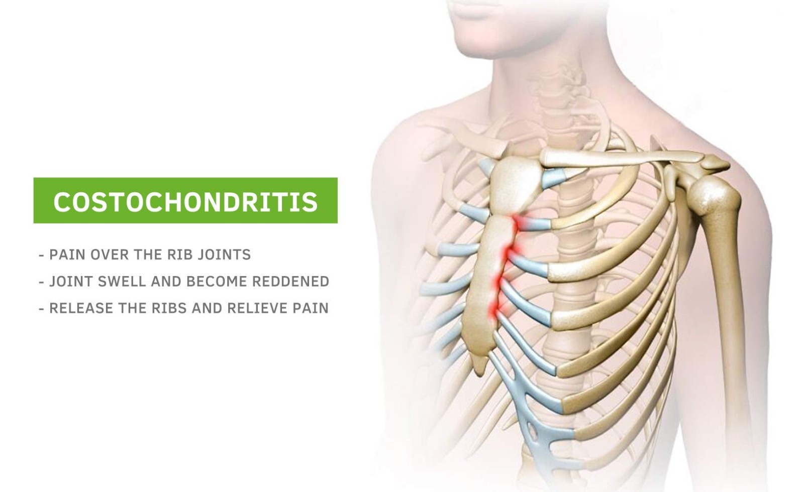 Upper Back Pain Relief, Headache Treatment, Costochondritis & Tietze Syndrome Ai