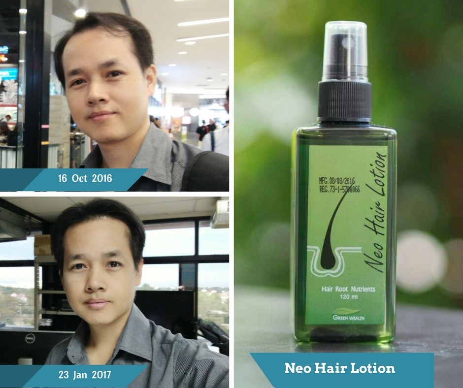 120ml. Neo Hair Lotion Hair Root HAIR BEARD SIDEBURNS LONGER Herbs 100%