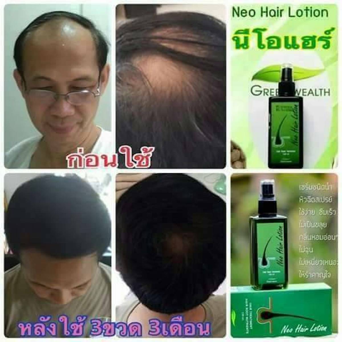 120ml. Neo Hair Lotion Hair Root HAIR BEARD SIDEBURNS LONGER Herbs 100%