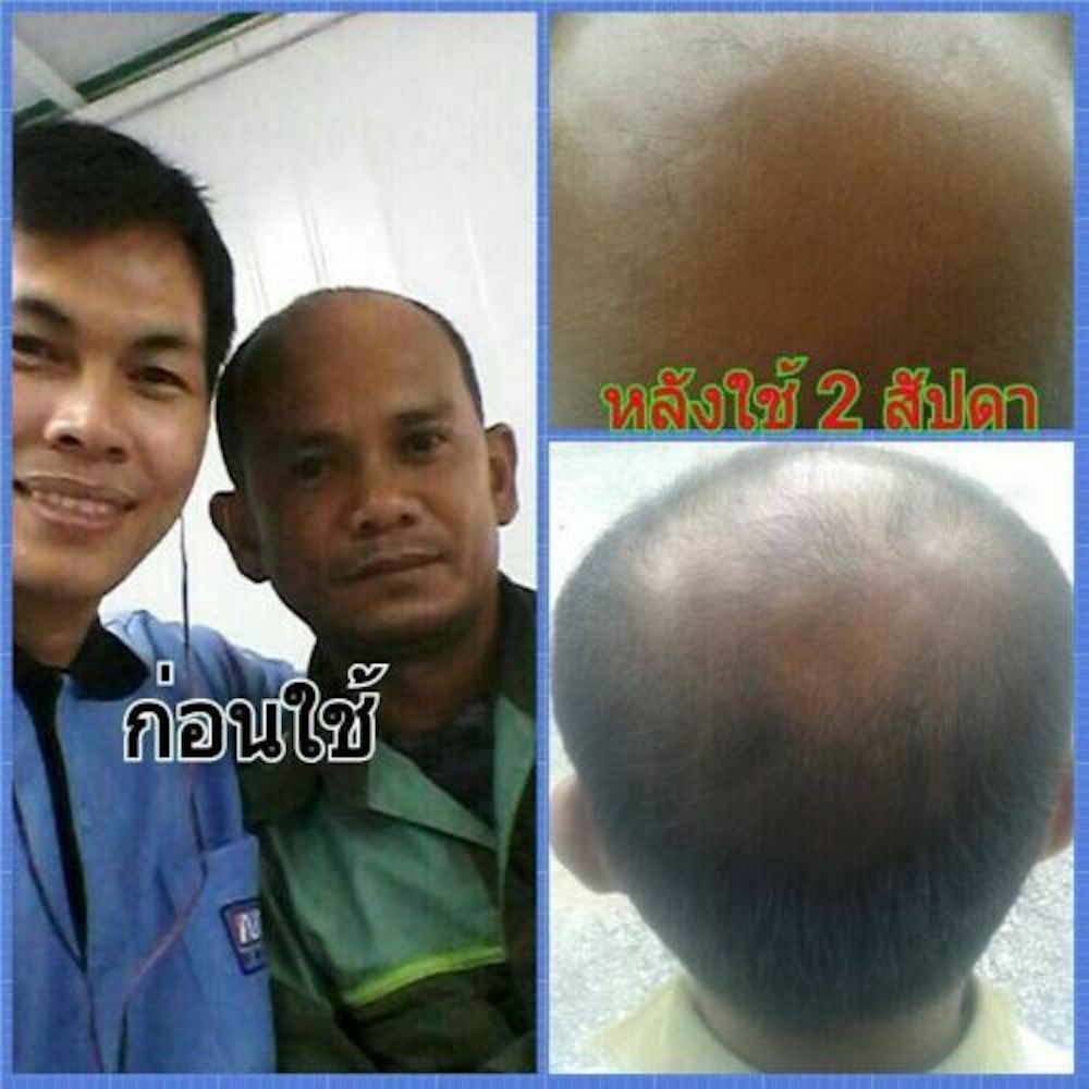 120ml. Neo Hair Lotion Hair Root HAIR BEARD SIDEBURNS LONGER Herbs 100%