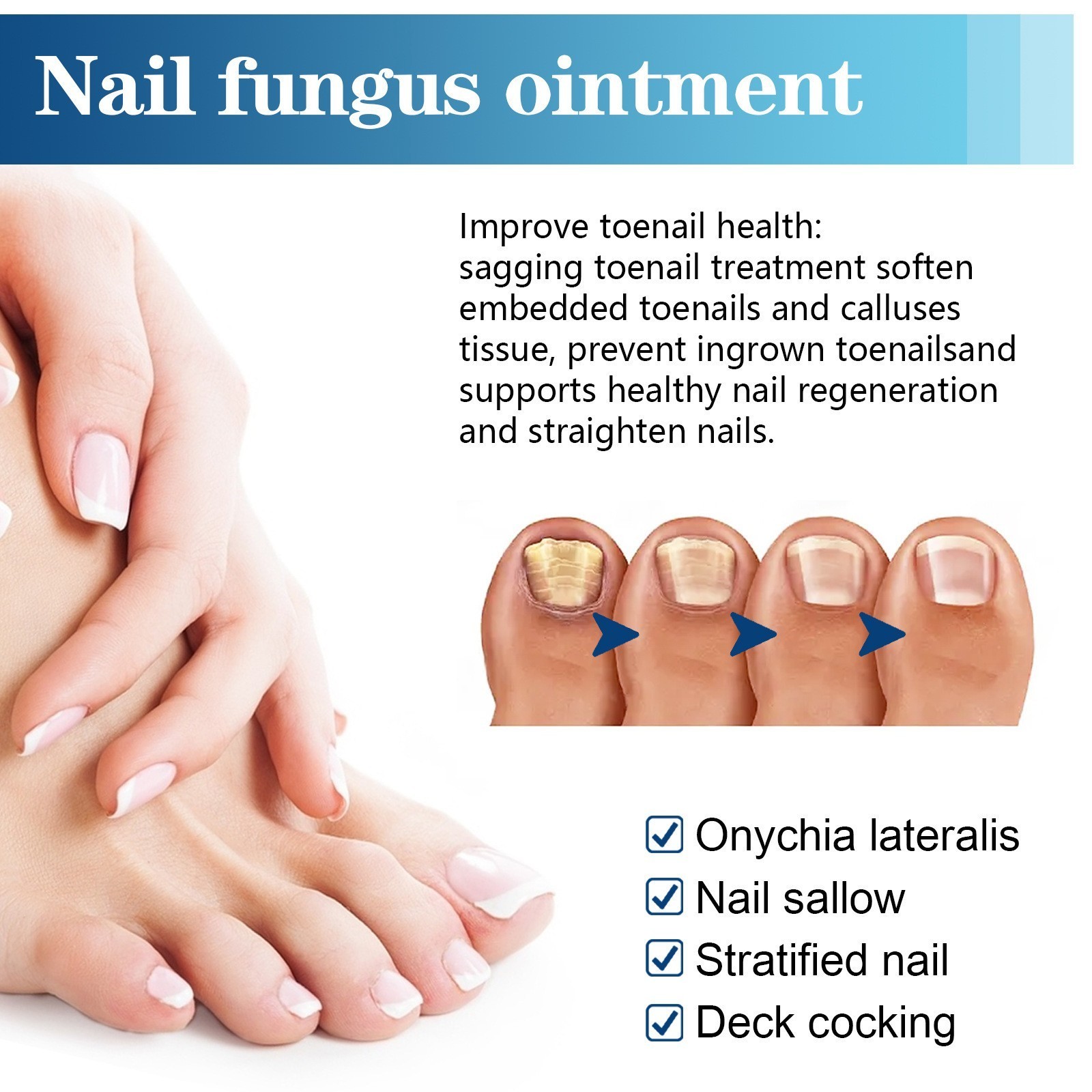 Nail Care Pen, 4/8/12Pcs Fungal Nail Pen, Nail Fungus Treatment For Toenail USA