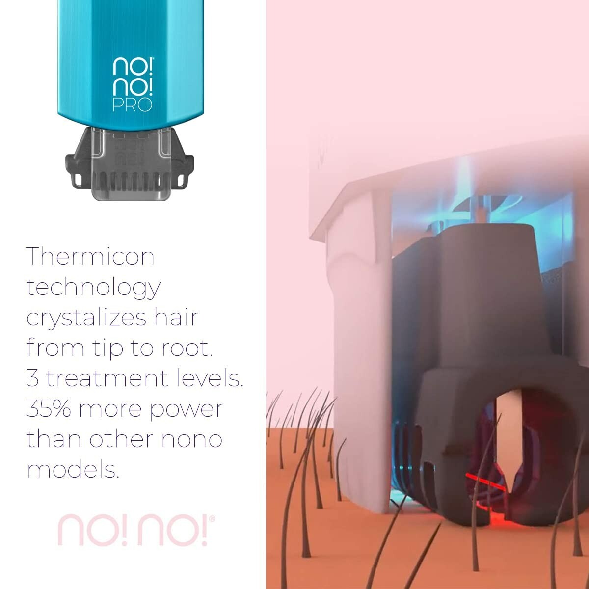 No!No! Pro Deluxe Hair Removal System – Hair Removal Treatment – NEW In Box