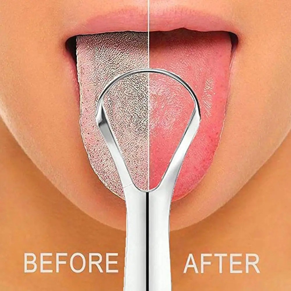 Stainless Steel Tongue Cleaner Scraper