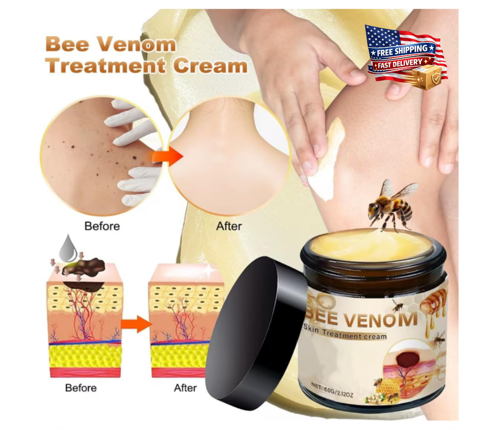 Bee Venom All-In-One Cream Skin Treatment 2026 Professional Bee Venom Cream 60g