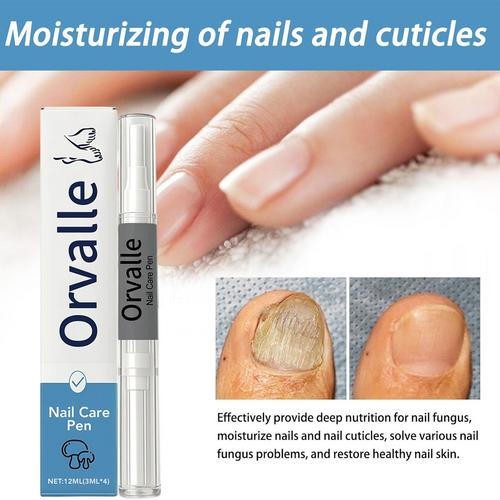 4 PCS Damaged Nail Fungus Pen Pen, Fingernail Restoration Care Orville 3ml/PCS`