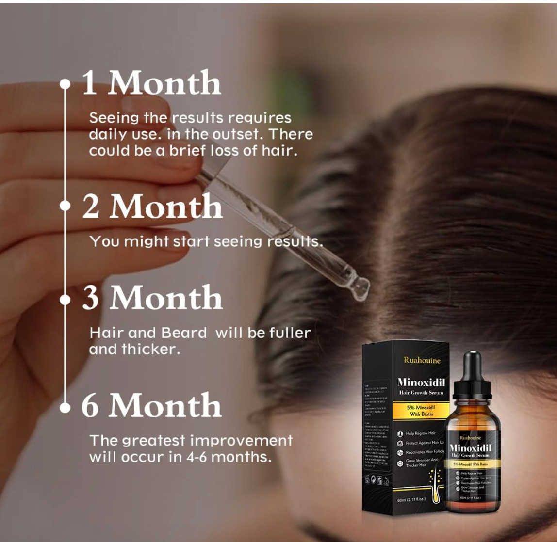 5% Minoxidil Hair Growth Serum for Men and Women, Hair Regrowth Treatment